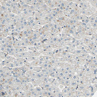 Immunohistochemical staining of human liver shows no positivity in hepatocytes as expected.