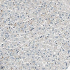 Immunohistochemical staining of human liver shows no positivity in hepatocytes as expected.