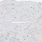 Immunohistochemical staining of human skeletal muscle shows no positivity in myocytes.