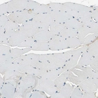 Immunohistochemical staining of human skeletal muscle shows no positivity in myocytes.