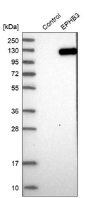 Western blot analysis in control (vector only transfected HEK293T lysate) and EPHB3 over-expression lysate (Co-expressed with a C-terminal myc-DDK tag (~3.1 kDa) in mammalian HEK293T cells, LY401410).