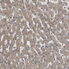 Anti-PSMA2 Antibody