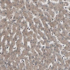 Anti-PSMA2 Antibody