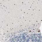 Immunohistochemical staining of human cerebellum shows strong nuclear positivity in Purkinje cells.