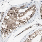 Immunohistochemical staining of human testis shows moderate nuclear and cytoplasmic positivity in cells in seminiferous ducts.