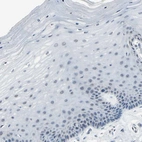 Immunohistochemical staining of human cervix, uterine shows no positivity in squamous epithelial cells as expected.