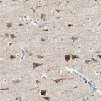 Immunohistochemical staining of human cerebral cortex shows strong cytoplasmic positivity in neurons.