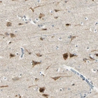 Immunohistochemical staining of human cerebral cortex shows strong cytoplasmic positivity in neurons.