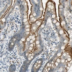 Immunohistochemical staining of human upper small intestine shows strong membranous positivity in glandular cells.