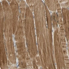 Immunohistochemical staining of human skeletal muscle shows strong cytoplasmic positivity in myocytes.
