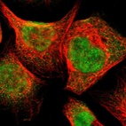 Immunofluorescent staining of human cell line A-431 shows localization to nucleus & cytosol.