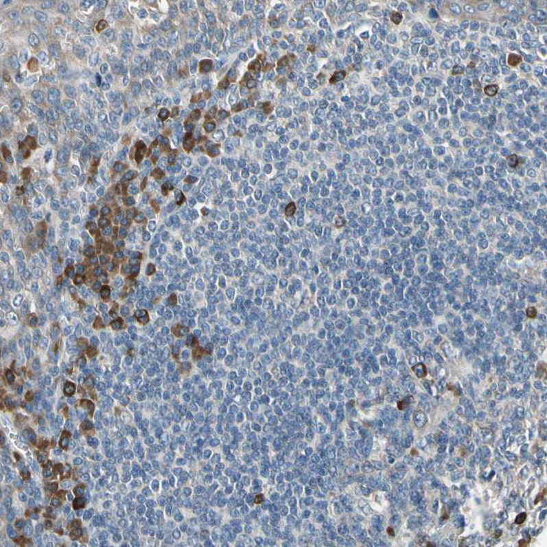 Anti-SELENOK Antibody