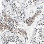 Immunohistochemical staining of human testis shows weak cytoplasmic positivity in Leydig cells.