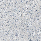 Immunohistochemical staining of human liver shows no positivity in hepatocytes.