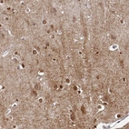 Immunohistochemical staining of human cerebral cortex shows moderate positivity in neuropil, as well as staining in glial cells.