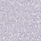 Immunohistochemical staining of human liver shows no positivity in hepatocytes as expected.