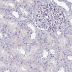 Immunohistochemical staining of human kidney shows no positivity in cells in tubules as expected.