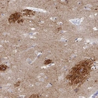 Immunohistochemical staining of human caudate nucleus shows moderate to strong positivity in neuronal processes.
