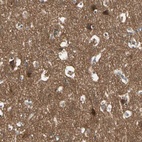 Immunohistochemical staining of human cerebral cortex shows high expression.