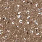 Immunohistochemical staining of human cerebral cortex shows high expression.
