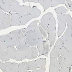 Immunohistochemical staining of human skeletal muscle shows low expression as expected.