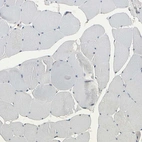 Immunohistochemical staining of human skeletal muscle shows low expression as expected.