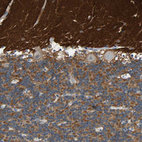 Immunohistochemical staining of human cerebellum shows strong positivity in molecular layer.