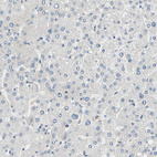 Immunohistochemical staining of human liver shows no positivity in hepatocytes as expected.
