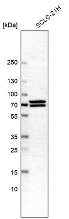 Western blot analysis in human cell line SCLC-21H.