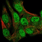 Immunofluorescent staining of human cell line SK-MEL-30 shows localization to nucleoplasm & cytosol.