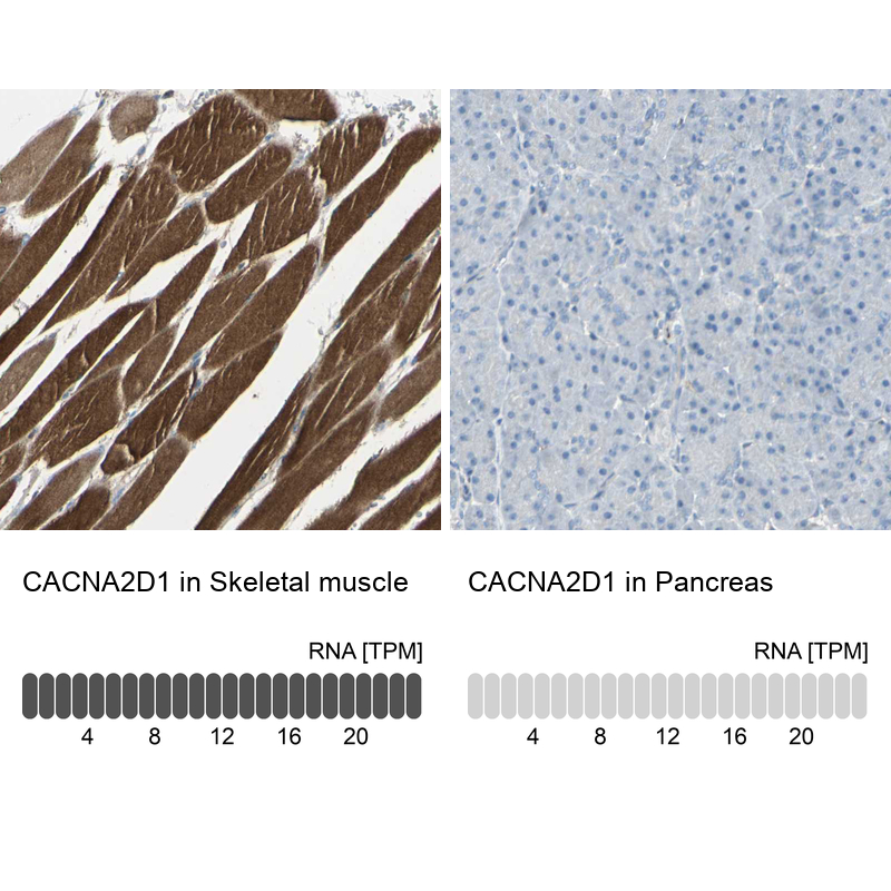 Anti-CACNA2D1 Antibody
