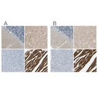 Immunohistochemical staining of human cerebellum, cerebral cortex, pancreas and skeletal muscle using Anti-CACNA2D1 antibody HPA008213 (A) shows similar protein distribution across tissues to independent antibody HPA008621 (B).