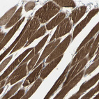 Immunohistochemical staining of human skeletal muscle shows strong cytoplasmic positivity in myocytes.
