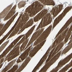 Immunohistochemical staining of human skeletal muscle shows strong cytoplasmic positivity in myocytes.