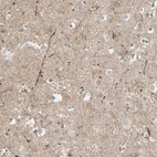 Immunohistochemical staining of human cerebral cortex shows moderate positivity in neuropil.
