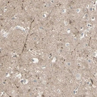 Immunohistochemical staining of human cerebral cortex shows moderate positivity in neuropil.