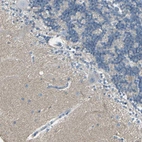 Immunohistochemical staining of human cerebellum shows weak positivity in neuropil.