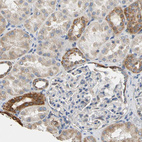 Immunohistochemical staining of human kidney shows moderate cytoplasmic positivity in cells in distal tubules.