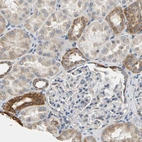 Immunohistochemical staining of human kidney shows moderate cytoplasmic positivity in cells in distal tubules.