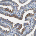 Immunohistochemical staining of human Fallopian tube shows moderate cytoplasmic/membranous positivity in glandular cells.