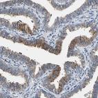 Immunohistochemical staining of human Fallopian tube shows moderate cytoplasmic/membranous positivity in glandular cells.