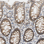 Immunohistochemical staining of human rectum shows moderate cytoplasmic/membranous positivity in glandular cells.