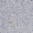 Immunohistochemical staining of human pancreas shows low positivity as expected.
