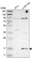 Western blot analysis in human cell line RT-4 and human cell line U-251 MG.