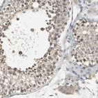 Immunohistochemical staining of human testis shows weak cytoplasmic positivity in cells in seminiferous ducts.