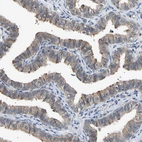 Immunohistochemical staining of human fallopian tube shows weak to moderate cytoplasmic positivity in glandular cells.