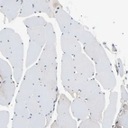 Immunohistochemical staining of human skeletal muscle shows low positivity in myocytes as expected.