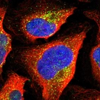 Immunofluorescent staining of human cell line U-2 OS shows localization to vesicles.