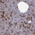 Immunohistochemical staining of human pancreas shows strong cytoplasmic positivity in intercalated ducts.