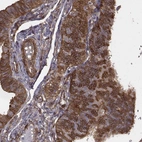 Immunohistochemical staining of human fallopian tube shows strong cytoplasmic positivity in glandular cells.